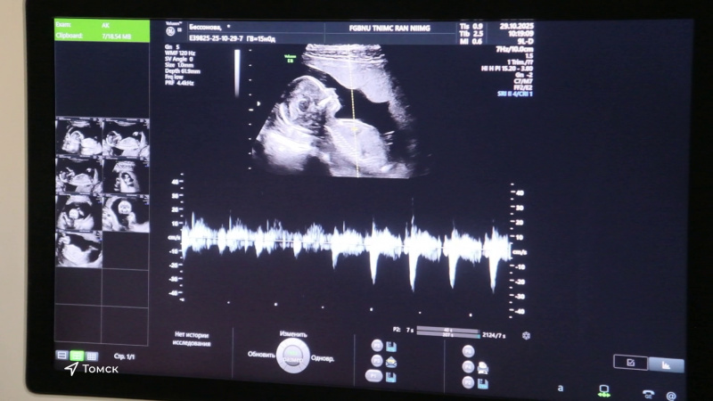 В Томске обсуждают достижения современной генетики. Томское время | Телеканал